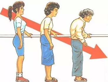 超声波骨密度仪