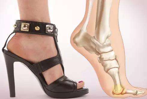 超声骨密度仪厂家之穿高跟鞋会造成膝盖损伤吗—山东国康