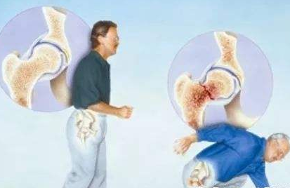 骨密度仪厂家提醒骨头易碎的人怎样预防？