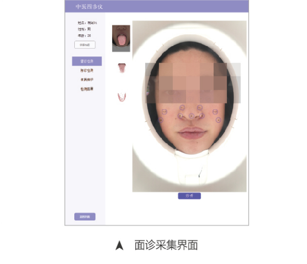 中医四诊仪02型（舌面脉信息采集管理系统）MT-SMT-02面诊采集界面.png