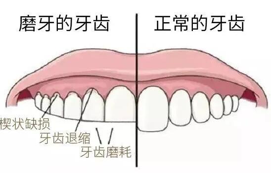 宝宝微量元素分析仪厂家国康提示宝宝夜磨牙或许是缺微量元素？